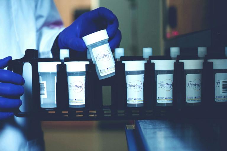 Multiple Thinprep vials on rack