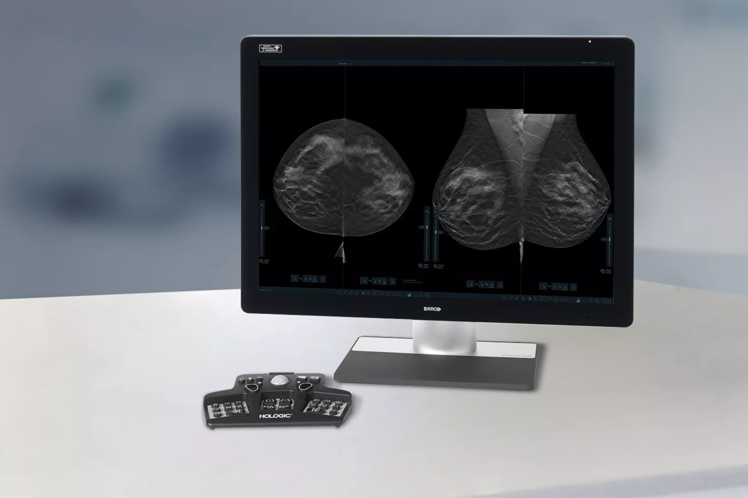 A workstation screen with a 3D mammography from Hologic