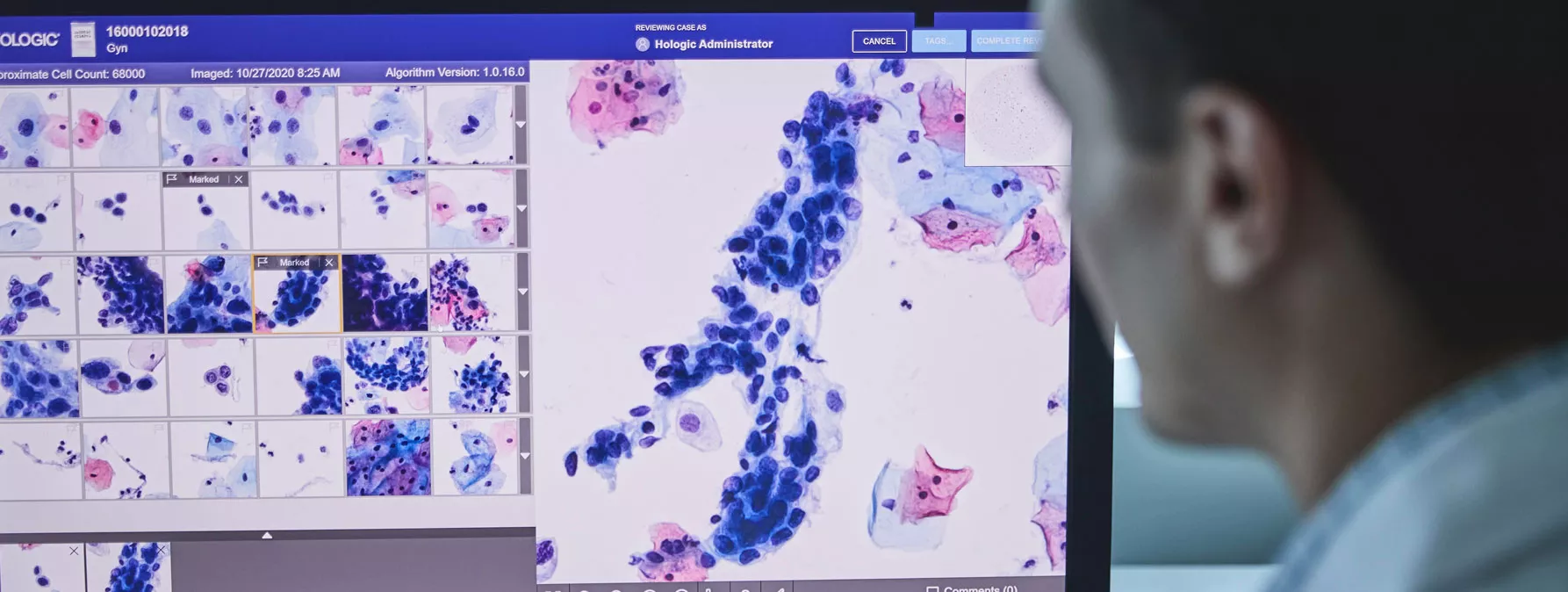 Genius™ Digital Diagnostics System image