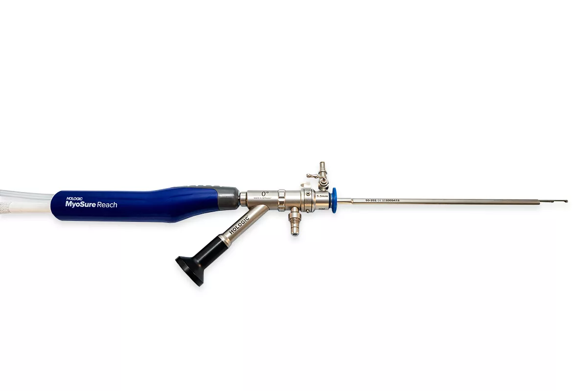 Hologic MyoSure Reach tissue removal device with an Omni Hysteroscope