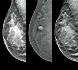 Hologic Hologic I-View® Contrast Enhanced Imaging